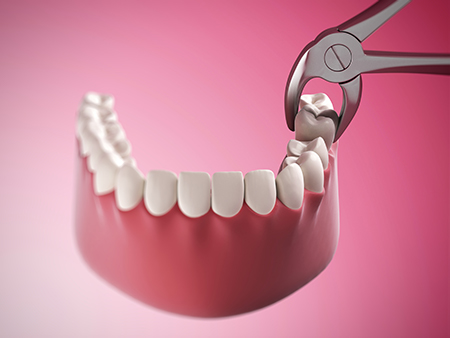 Black Mountain Family Dentistry | Implant Dentistry, Dental Bridges and Teeth Whitening